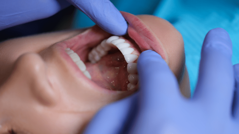 What Are Full Mouth Dental Implants in Turkey?