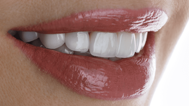 Top 3 Smile Makeover Options