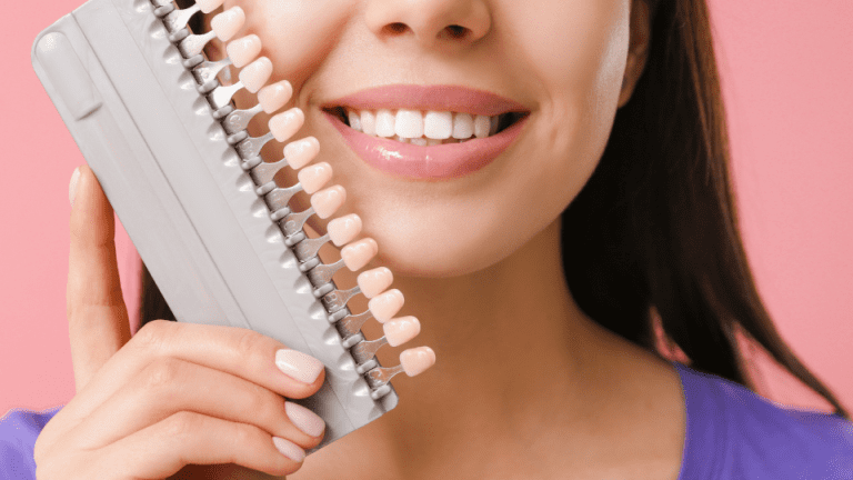 Composite Laminate Veneer Applications: Enhance Your Smile with Pearly White Gateway