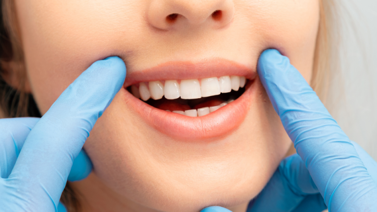 Is Teeth Whitening in Turkey Worth It?